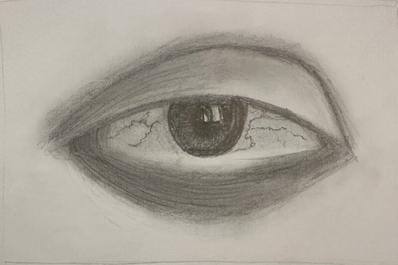 eye_before